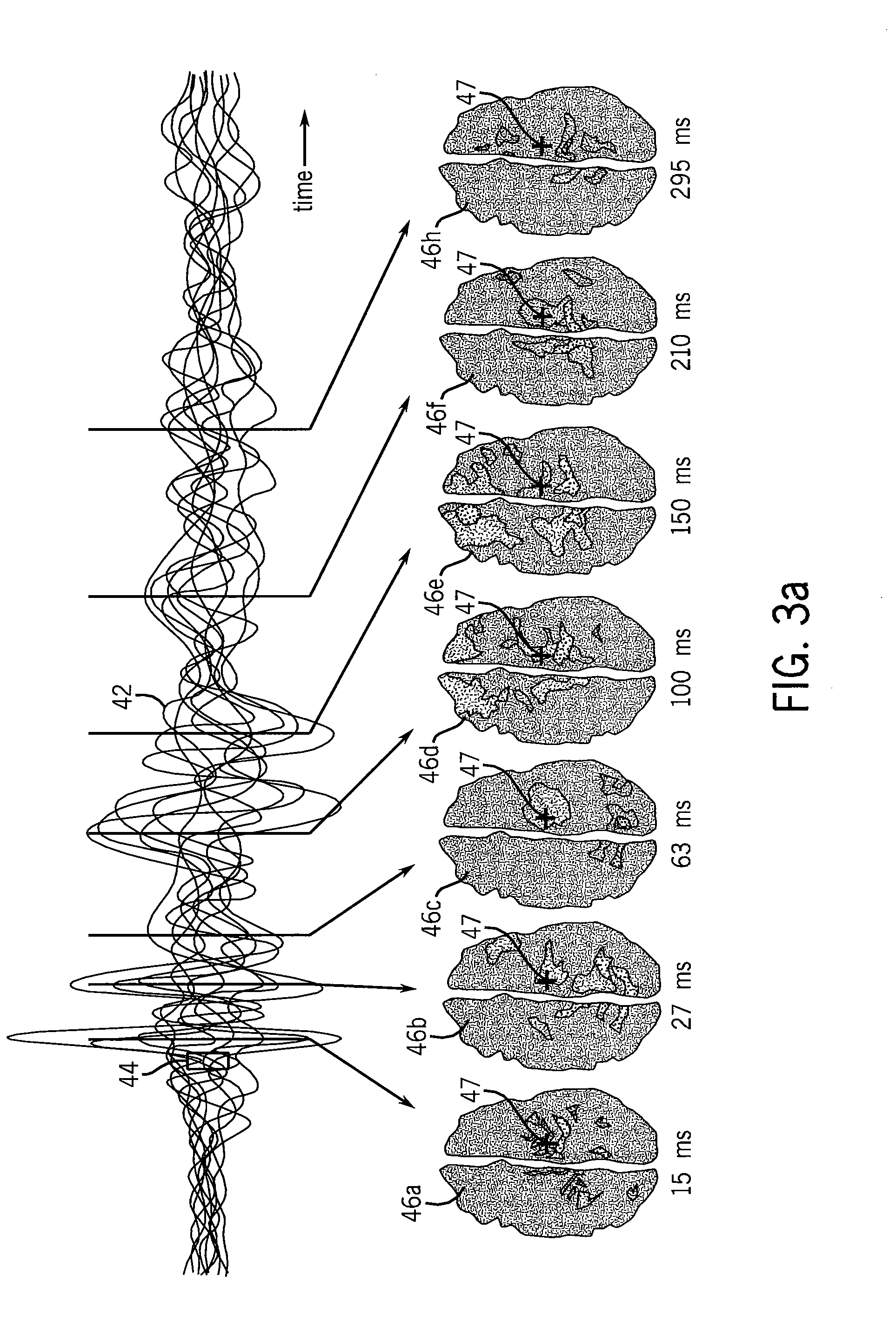 Method for assessing anesthetization