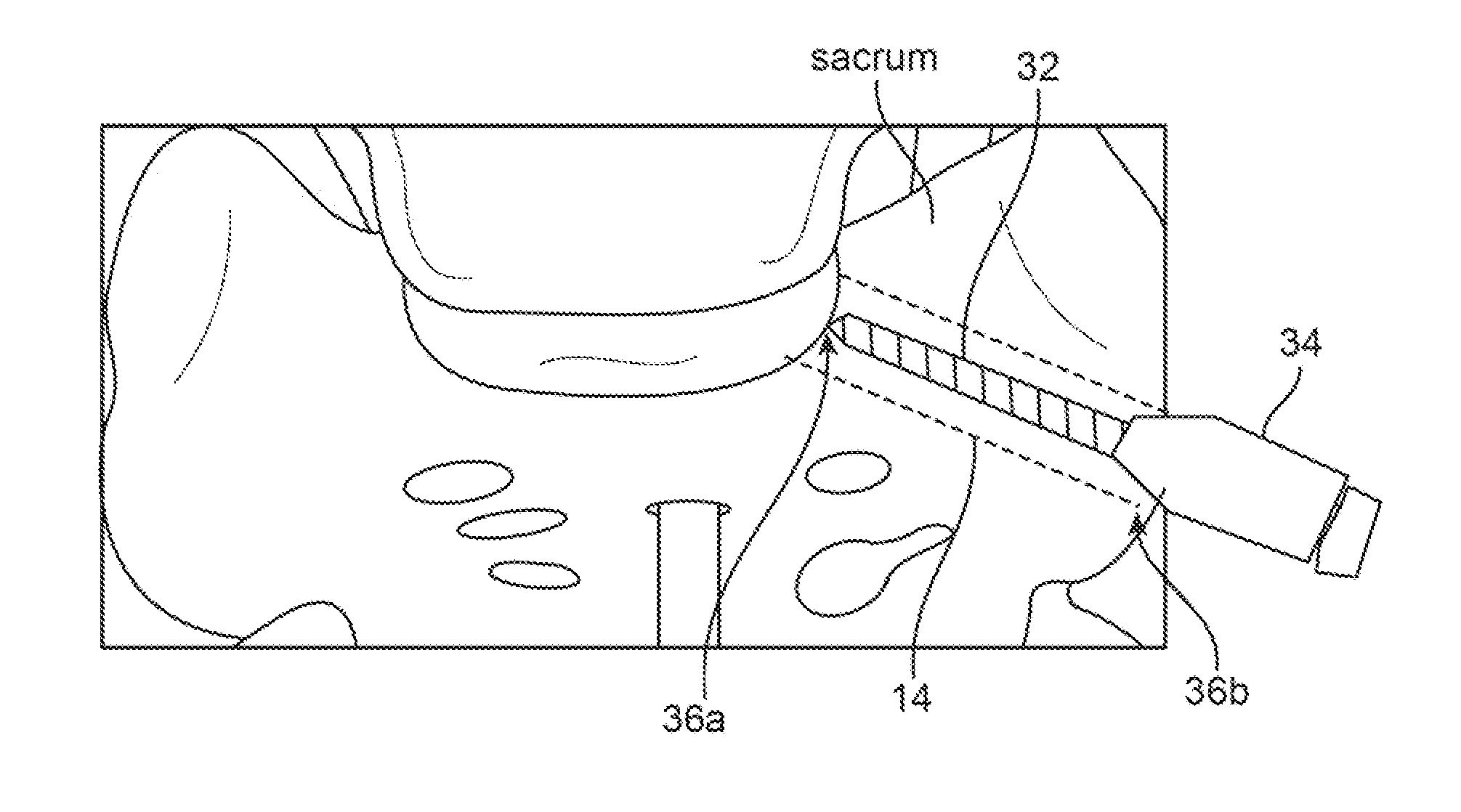Support device and method