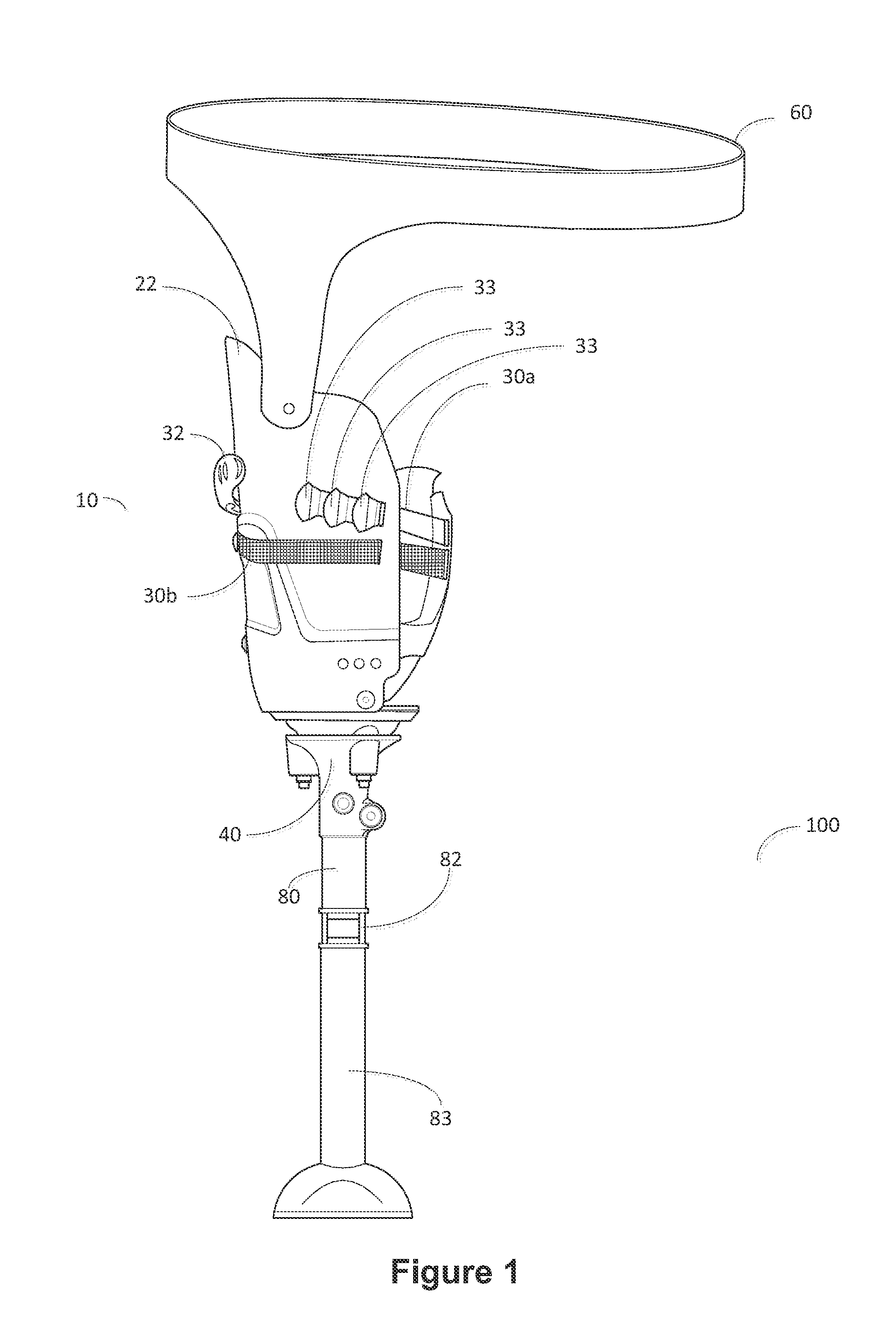 Above-the-Knee Modular Prosthesis System