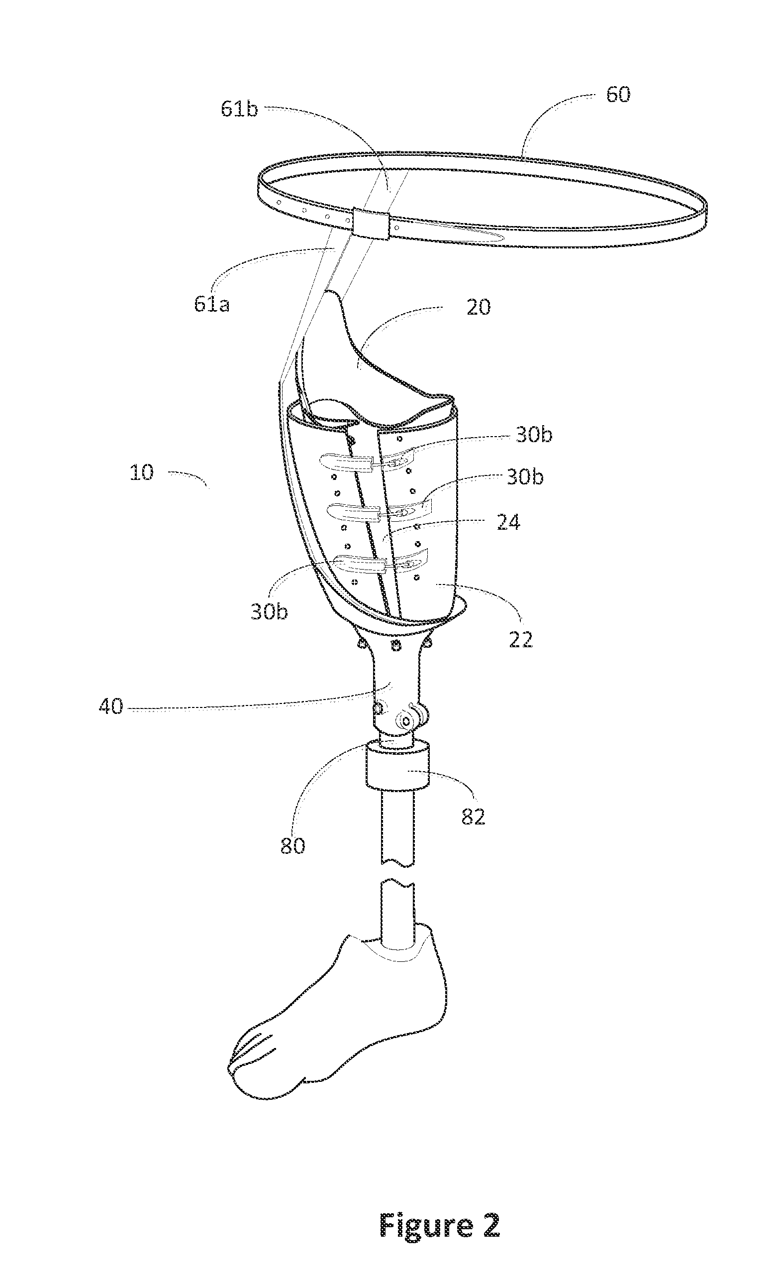 Above-the-Knee Modular Prosthesis System