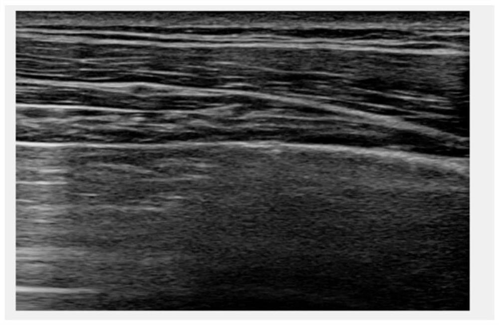 Pleura line identification method and system based on lung ultrasound