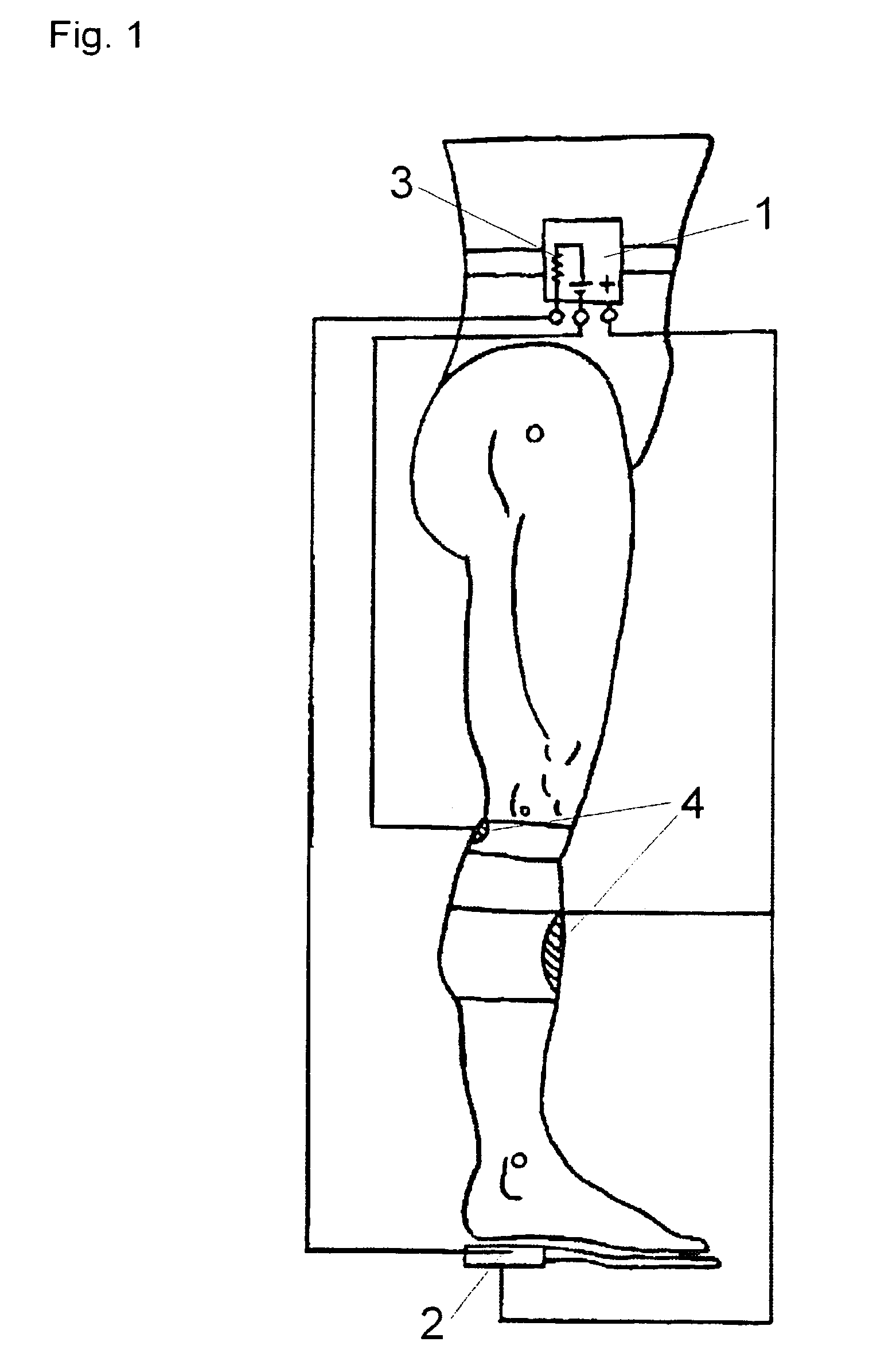 Method and implantable systems for neural sensing and nerve stimulation