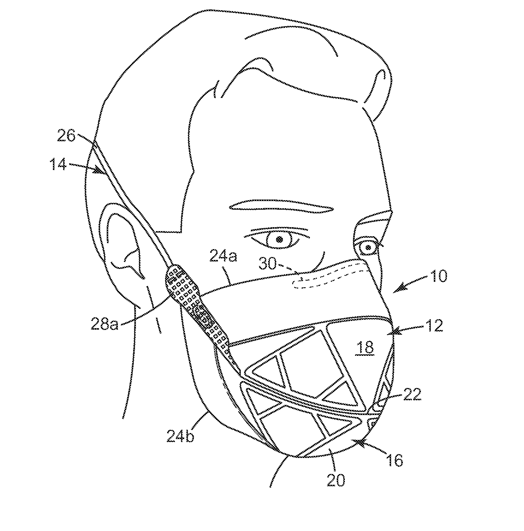 Filtering face-piece respirator having parallel line weld pattern in mask body