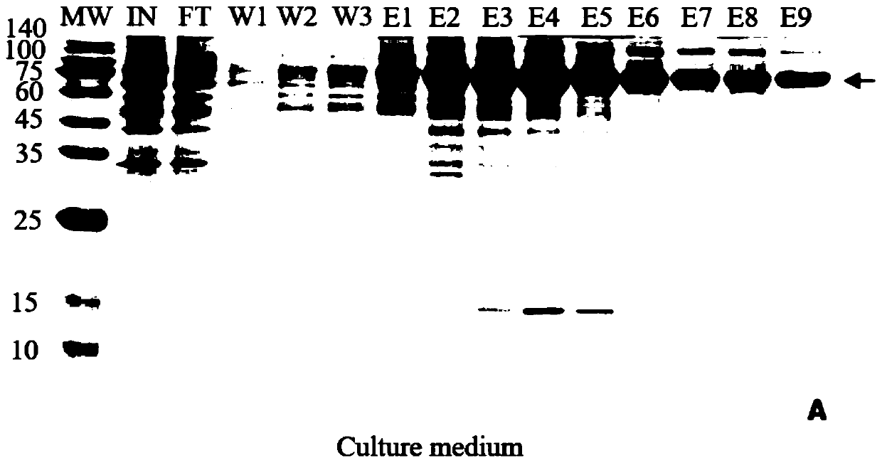 Monoclonal antibody inhibiting tissue organ fibrosis and neovascularization, and preparation method and application thereof