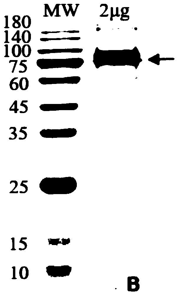 Monoclonal antibody inhibiting tissue organ fibrosis and neovascularization, and preparation method and application thereof