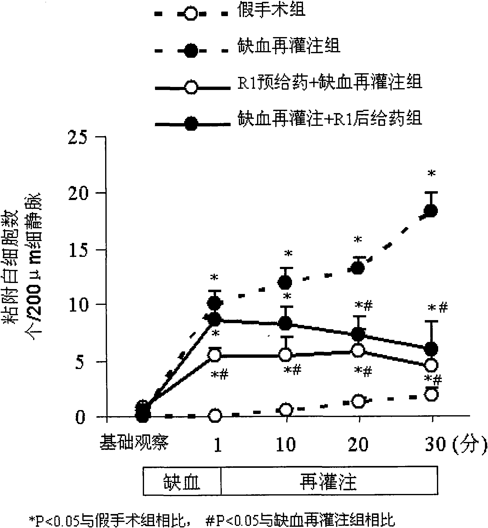 Prevention and treatment of diseases induced by microcirculation disturbance with panax notoginseng saponins R1