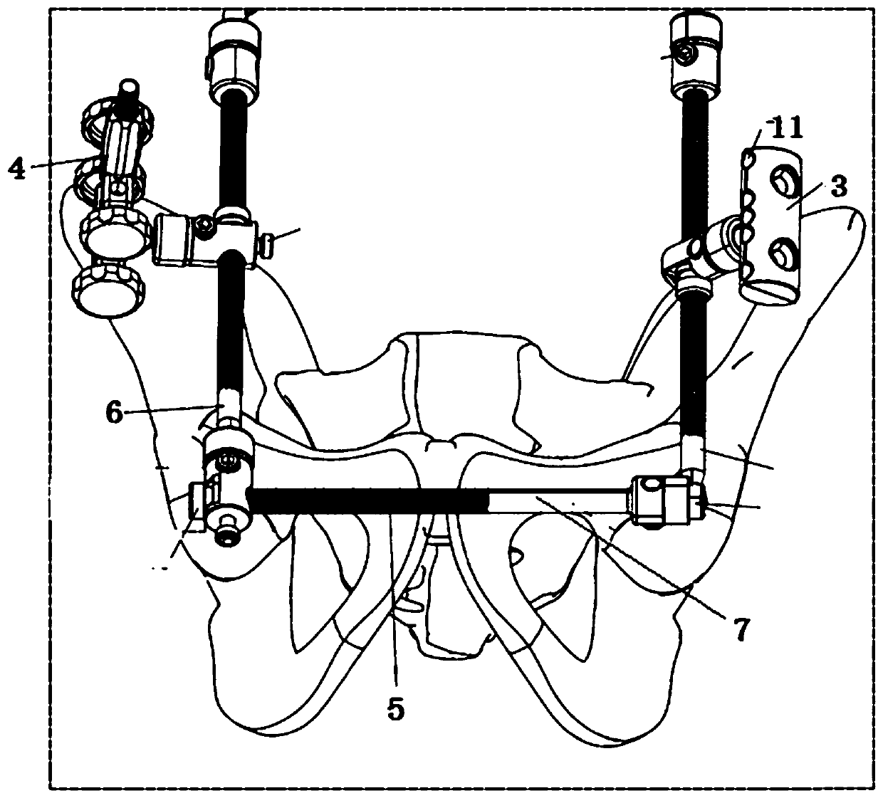 Integral external fixator for anterior and posterior pelvic rings