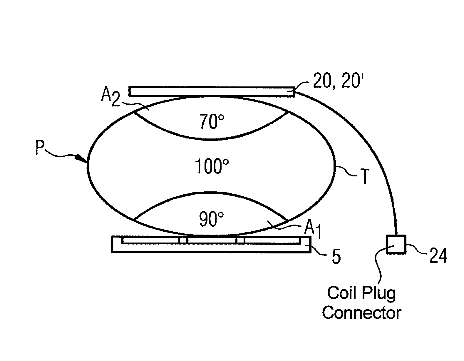 Magnetic resonance apparatus, method and auxilliary coil element for manipulation of the b1 field