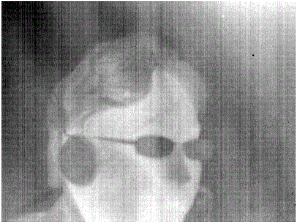 Elimination method for eliminating stripe noise of infrared image