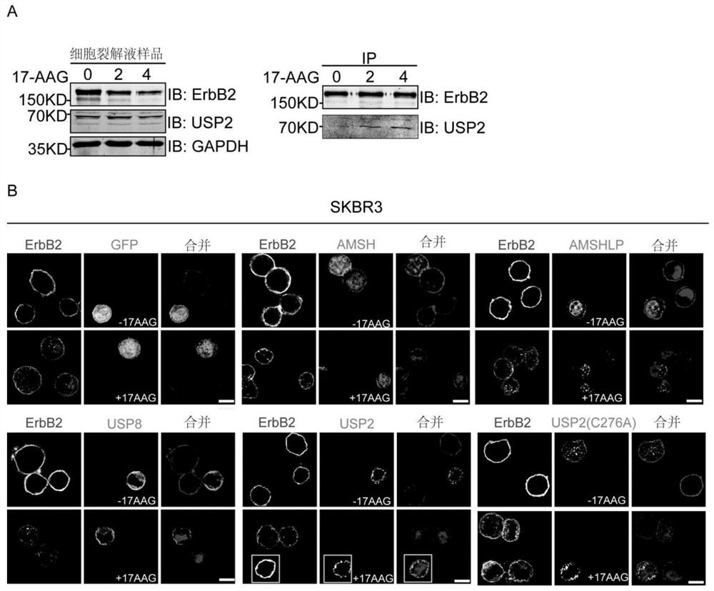 Combined use of USP2 and HSP90 inhibitors to inhibit the growth of ERBB2-positive breast cancer