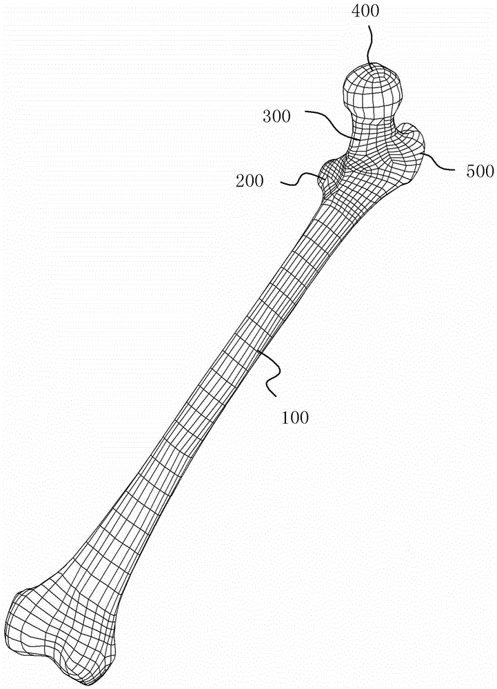 Three-dimensional reverse customization femoral neck fracture surgical navigator and using method thereof