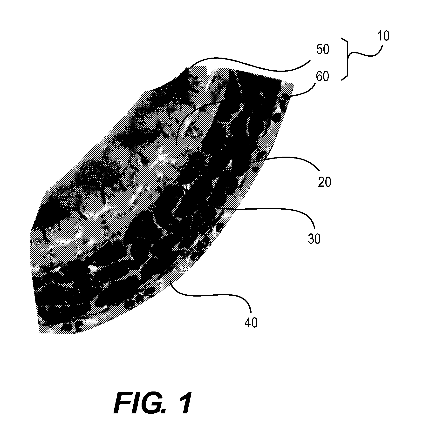 Apparatus for treating an organ and related methods of use