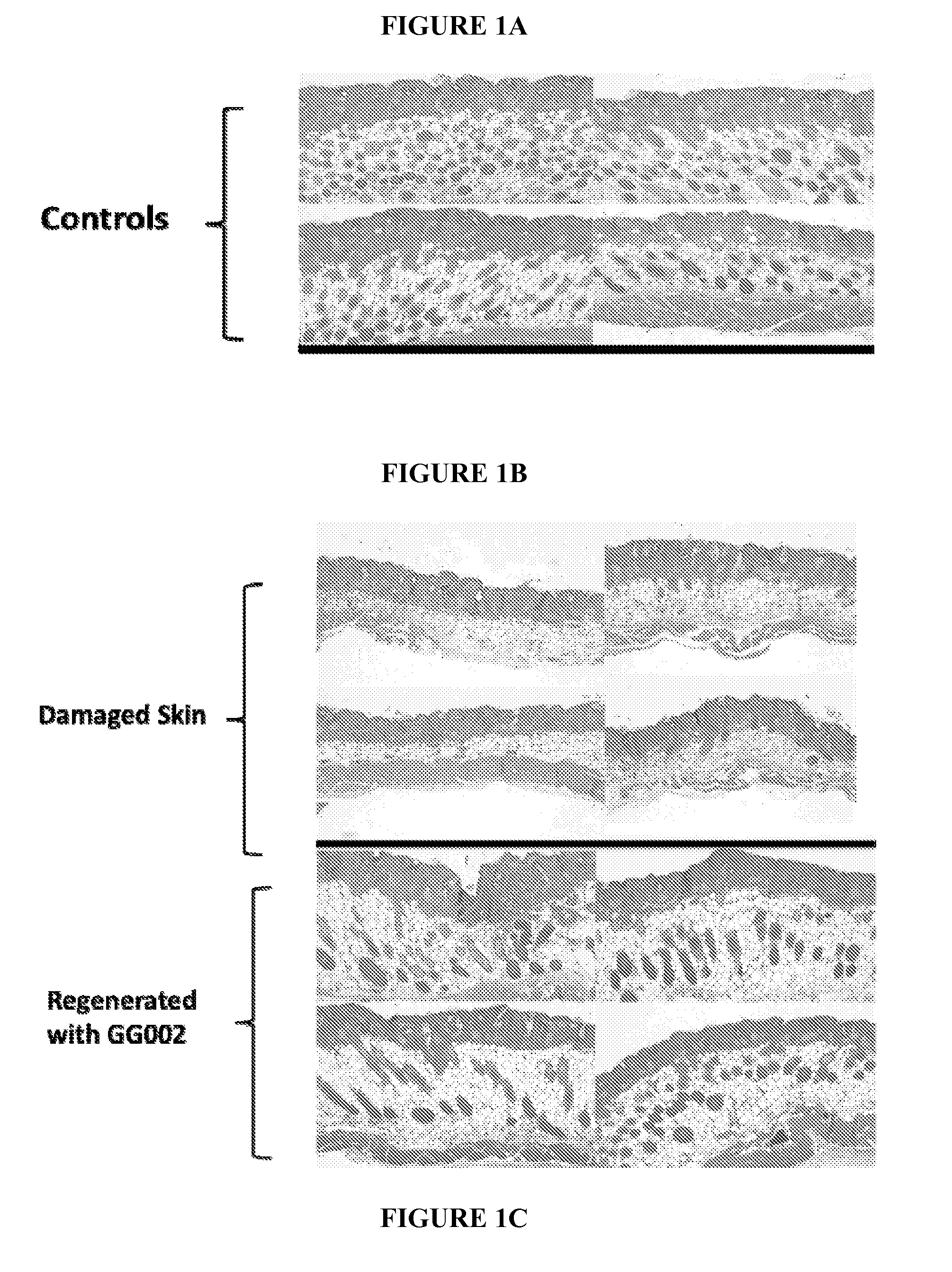 Methods and compositions for skin regeneration