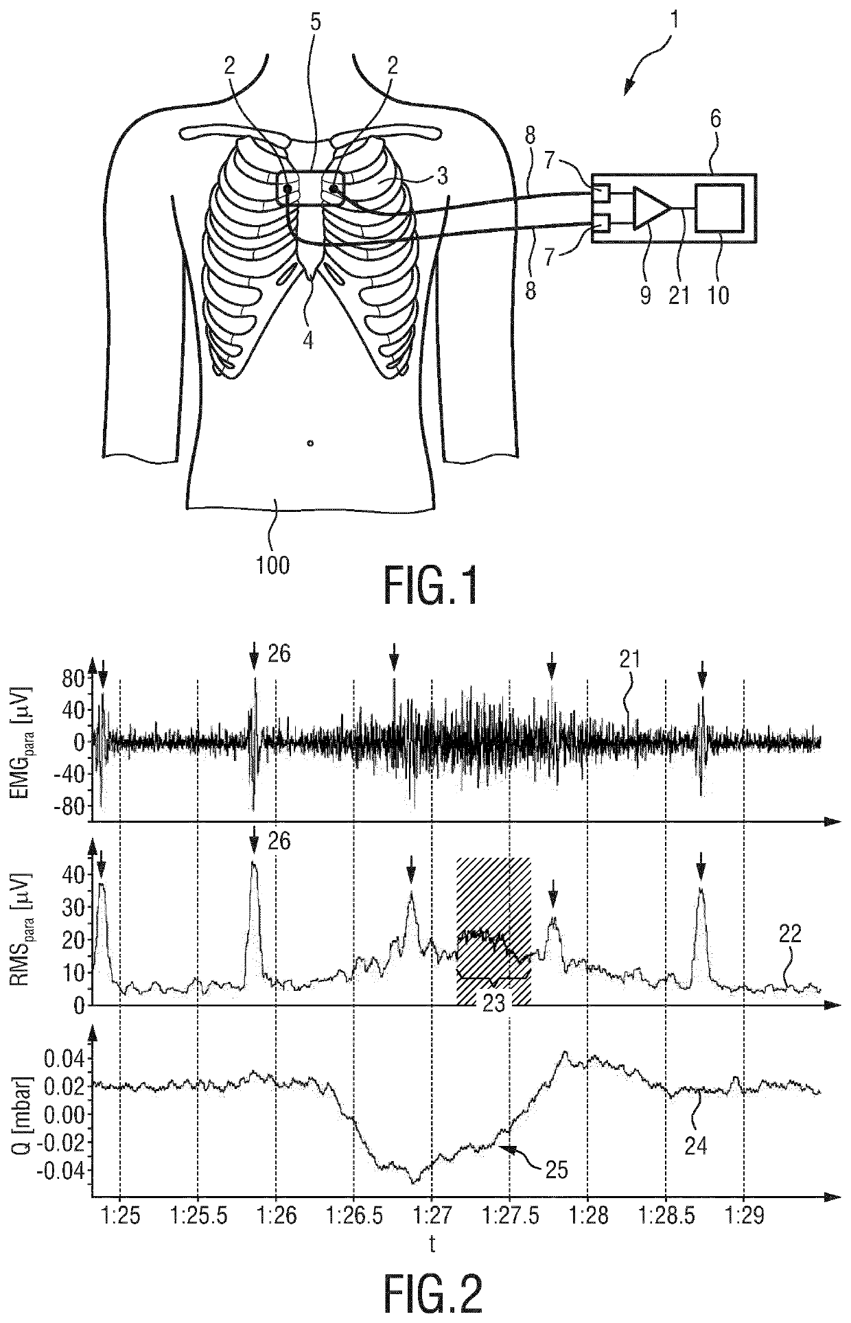 Processing apparatus for processing a physiological signal