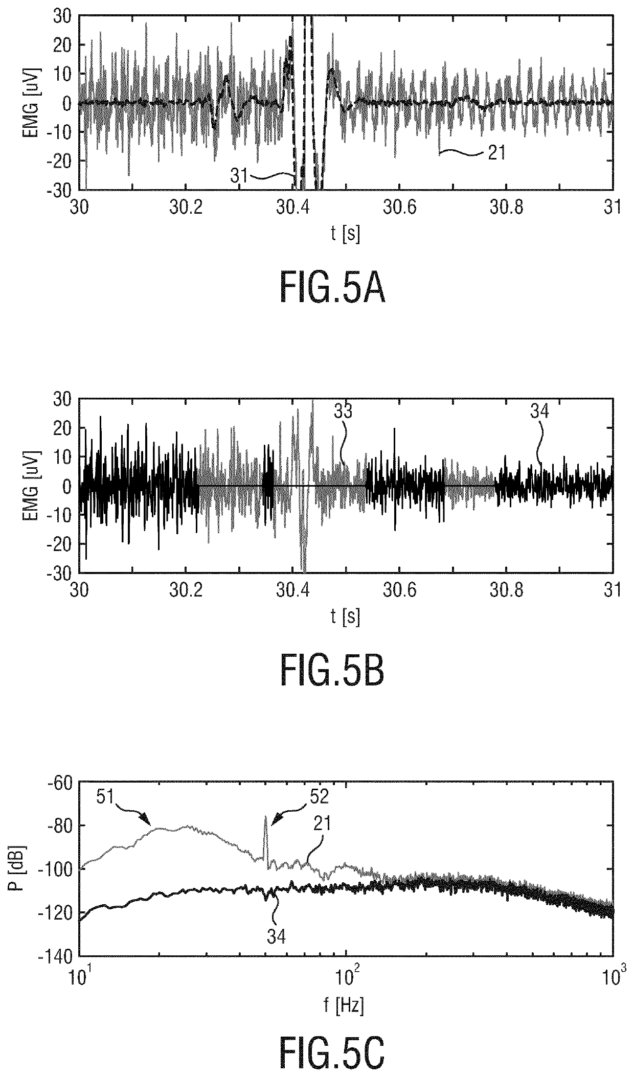 Processing apparatus for processing a physiological signal