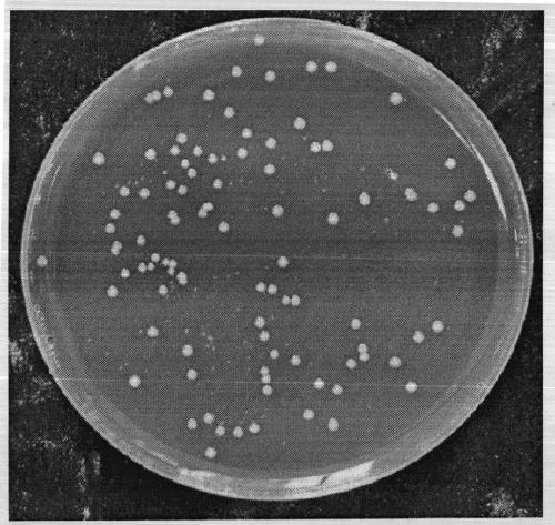 A kind of Bacteroides fragilis and its application