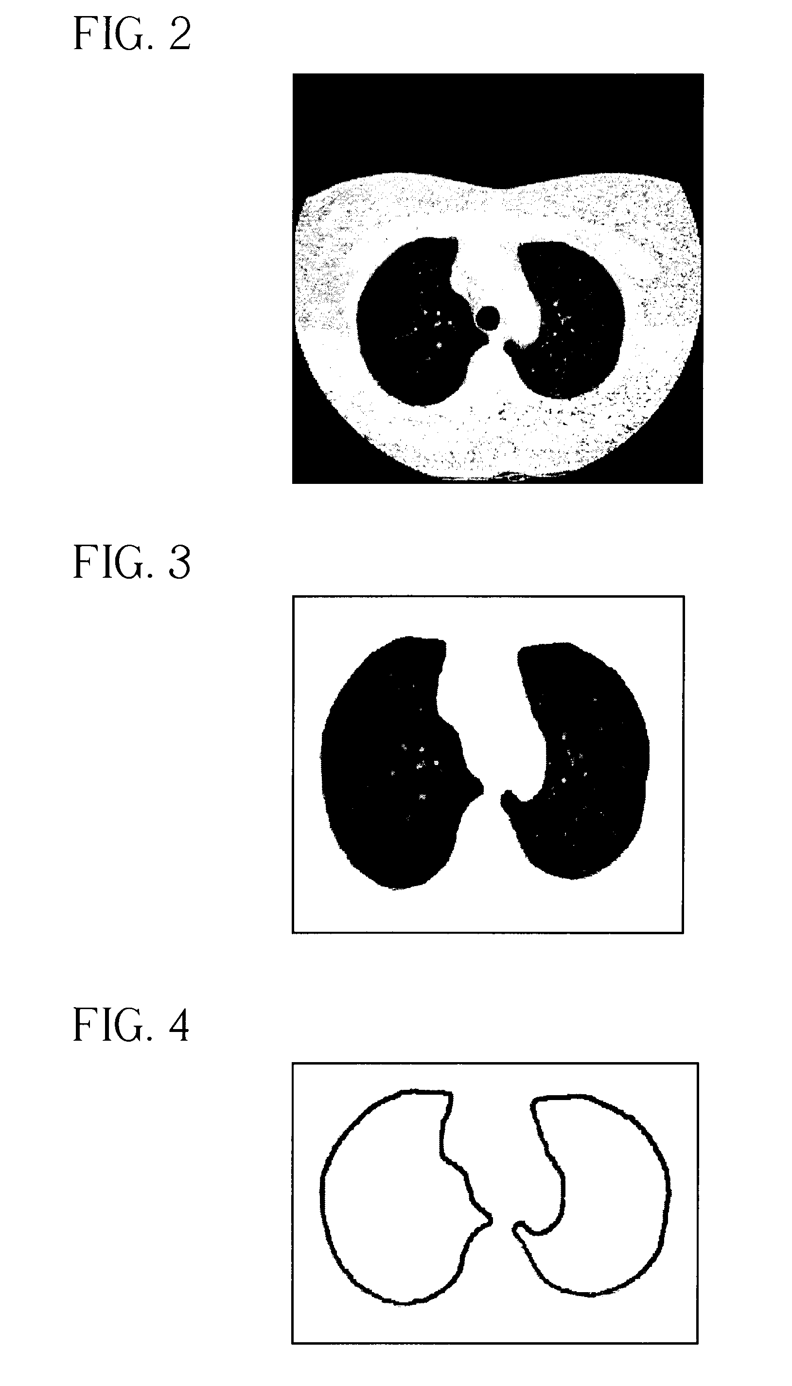 System, Method and Apparatus for Small Pulmonary Nodule Computer Aided Diagnosis from Computed Tomography Scans