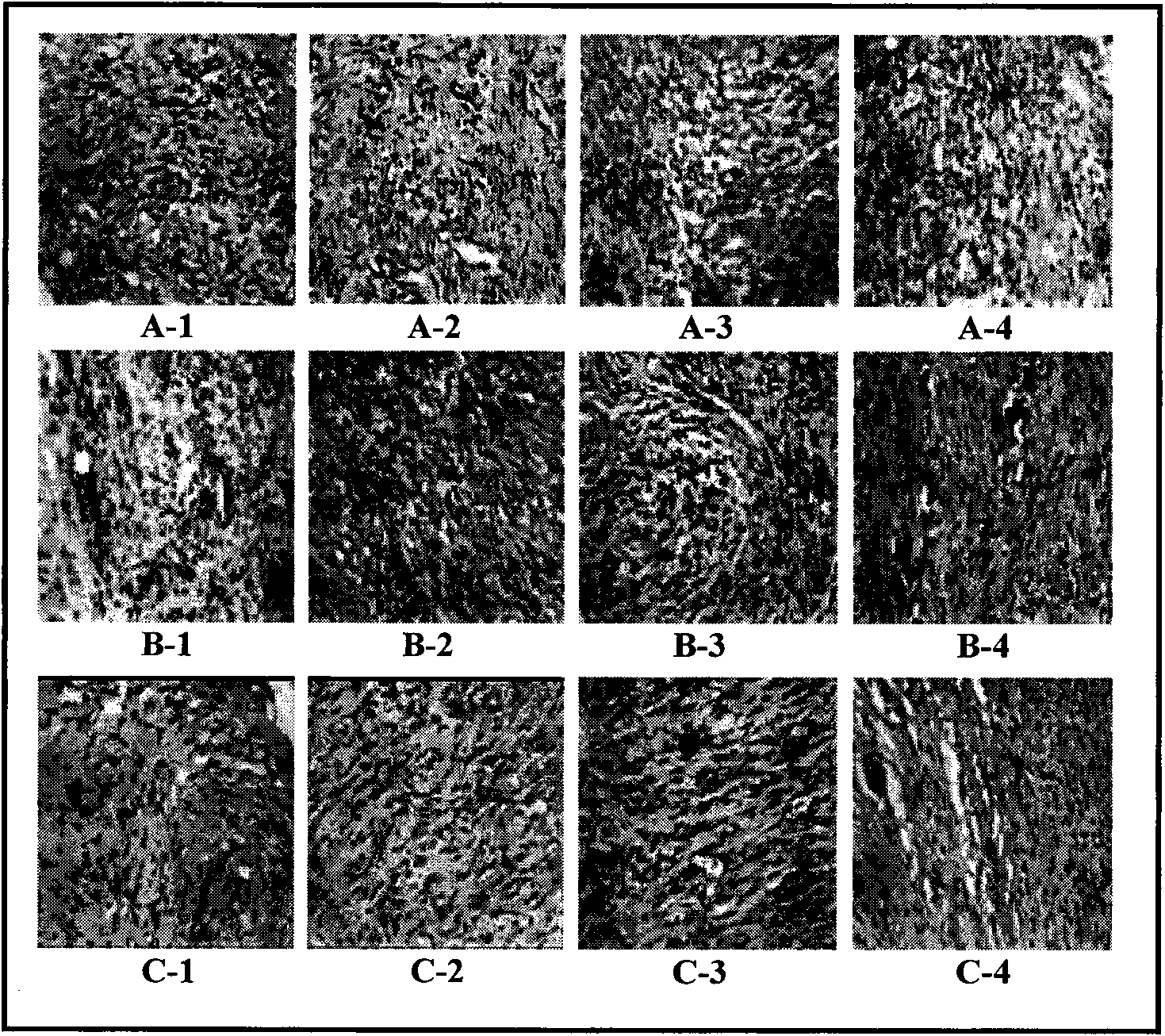 Particle blood platelet dry powder preparation and preparation method thereof and application thereof