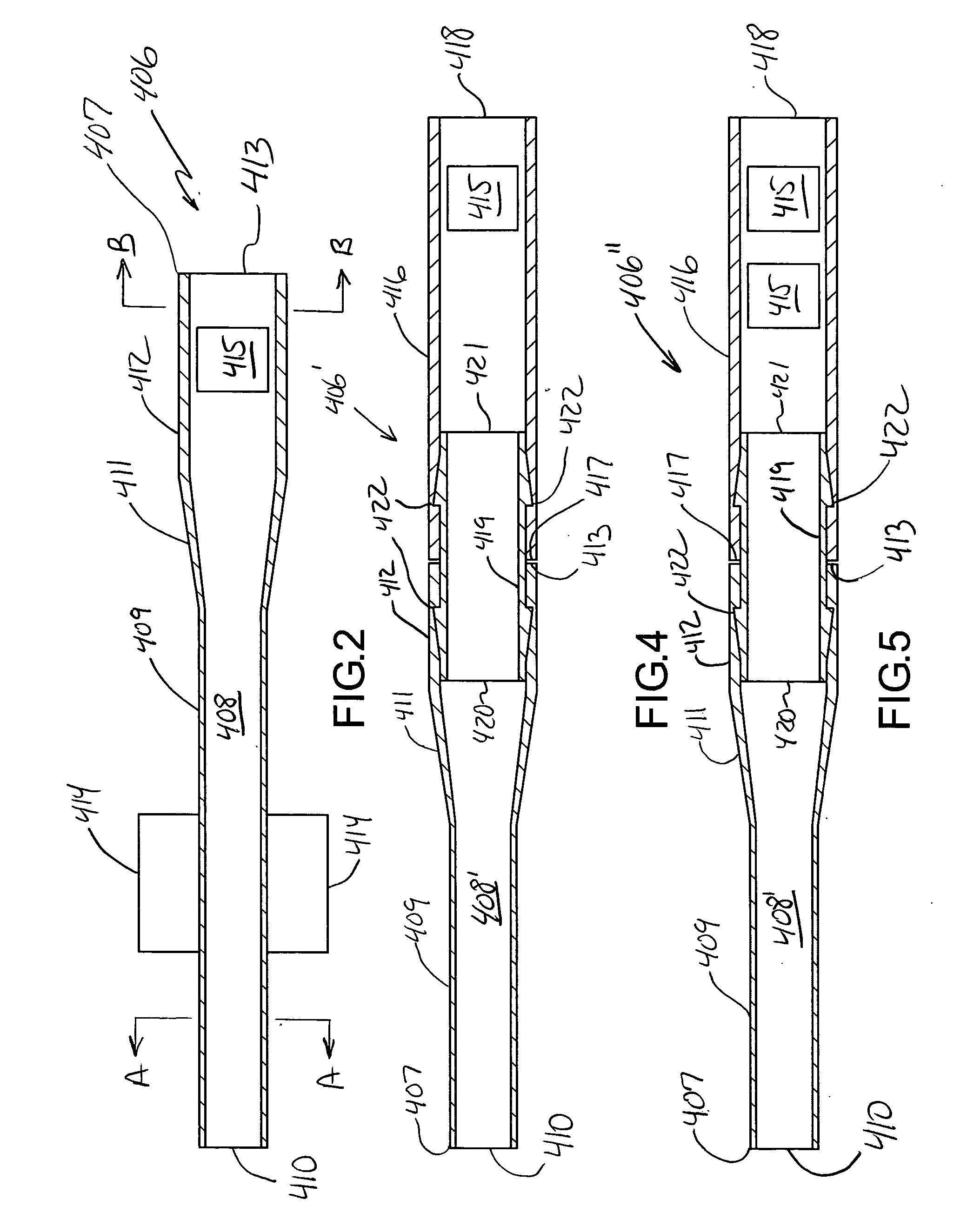 System and method for treating glaucoma