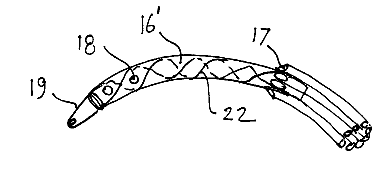 Expandable catheter for delivery of fluids