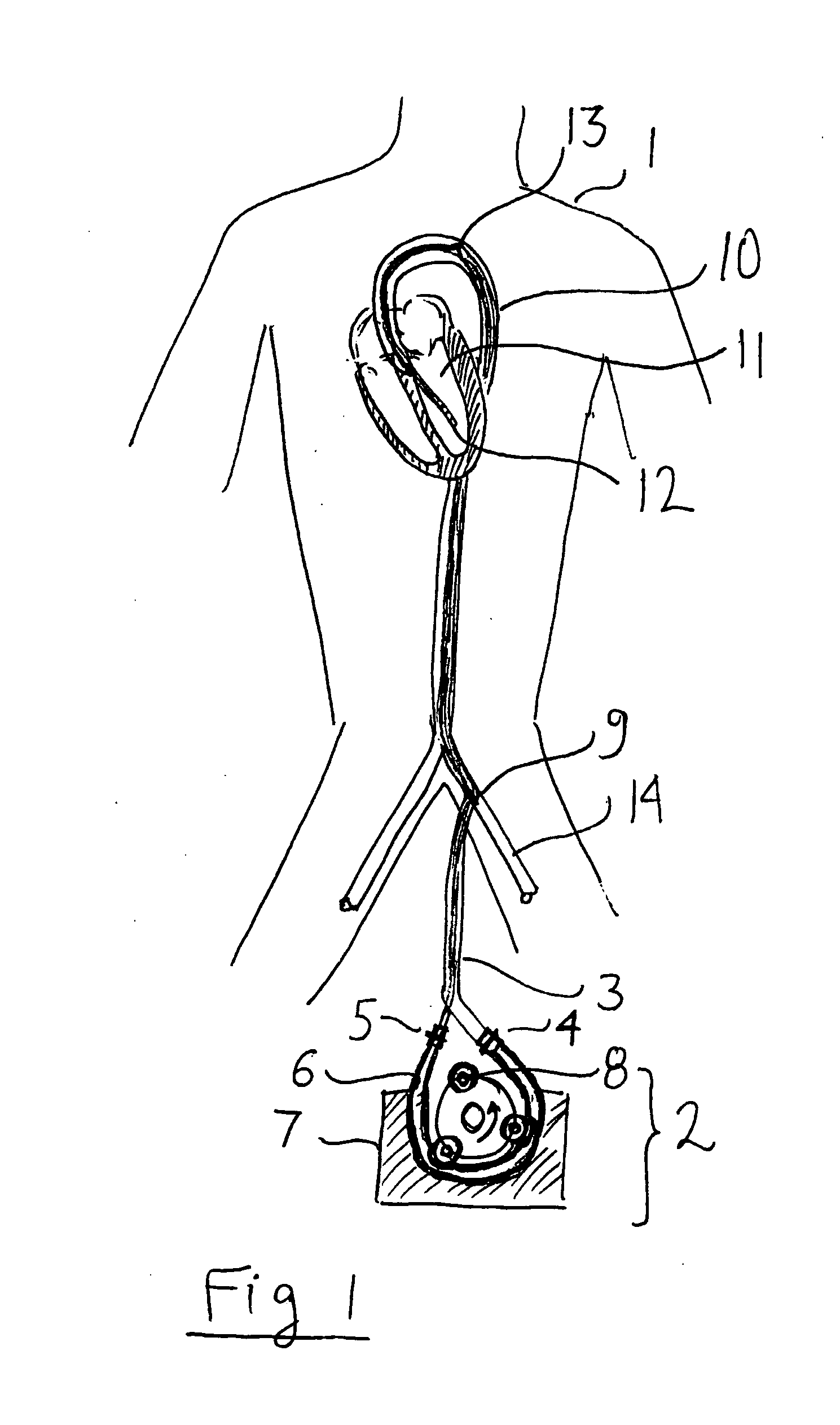 Expandable catheter for delivery of fluids