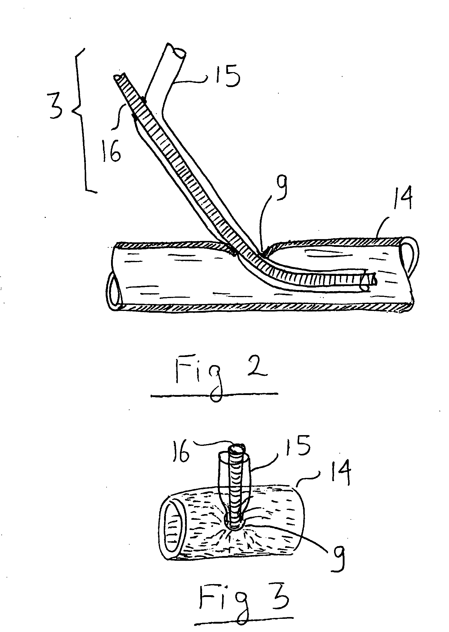 Expandable catheter for delivery of fluids