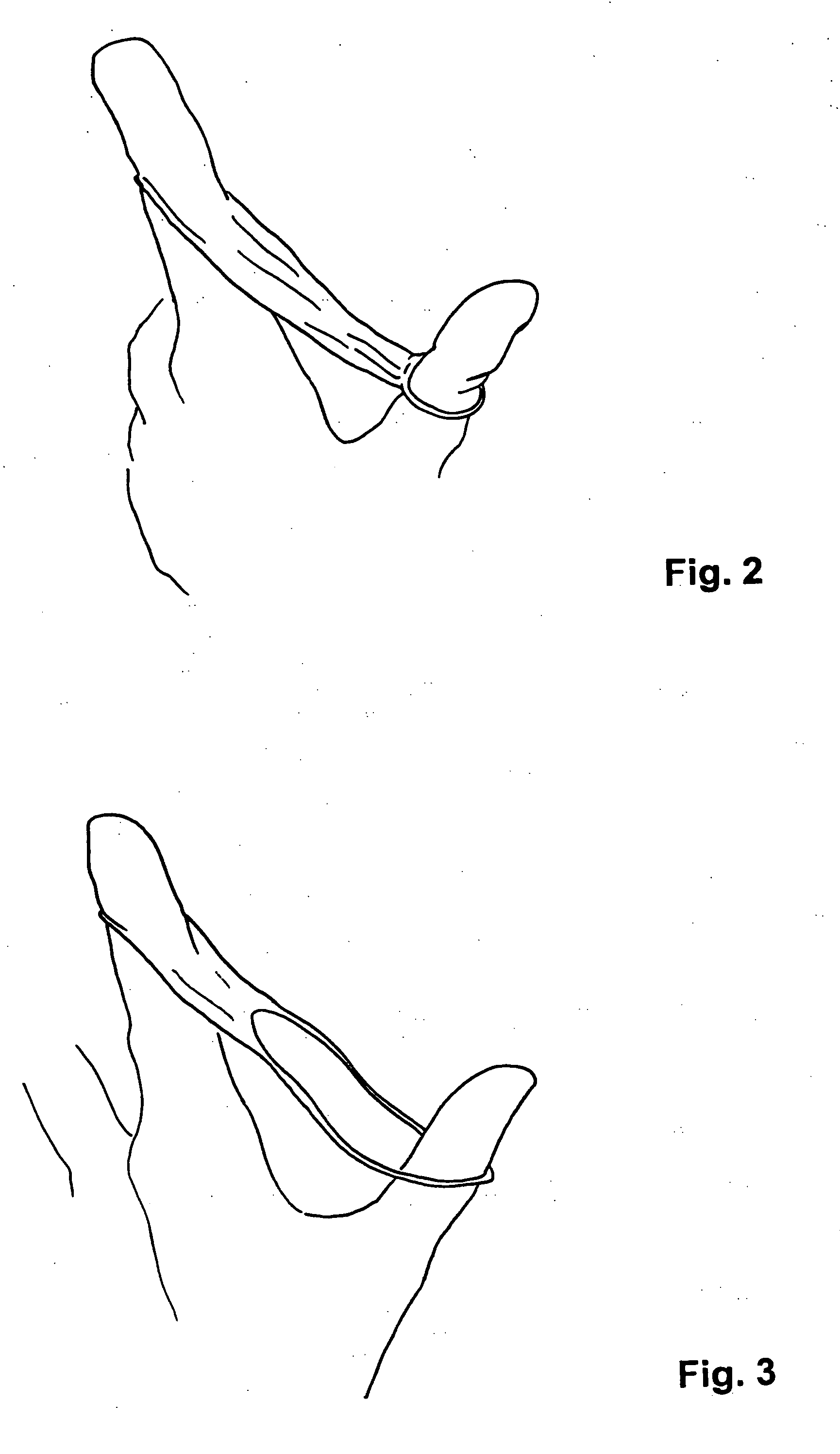 Device allowing careful dental prevention and hygiene