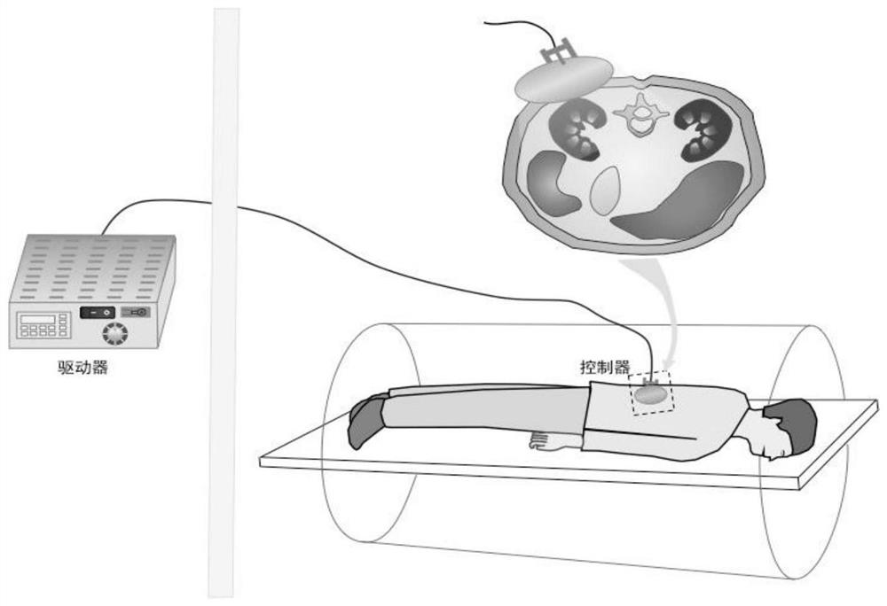 Renal fibrosis evaluation method based on magnetic resonance elastography and serological examination