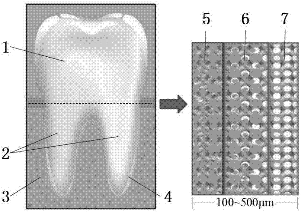 ZrO2-based all-ceramic dental implant and preparation method thereof