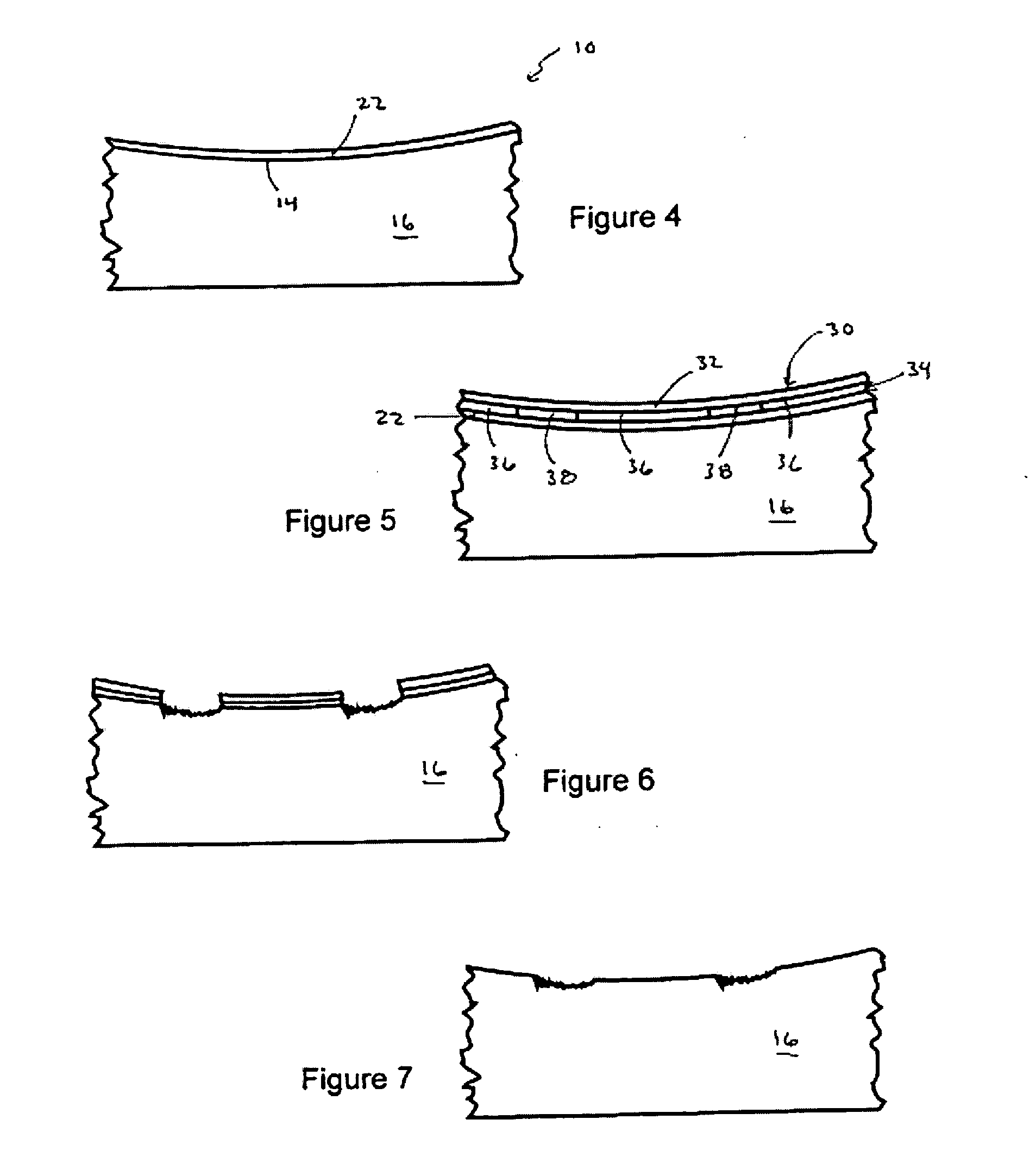 Product and method for protecting metal during etching