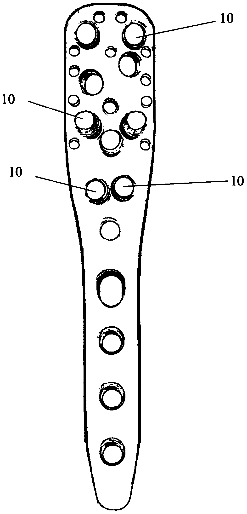 Proximal Humerus Plate