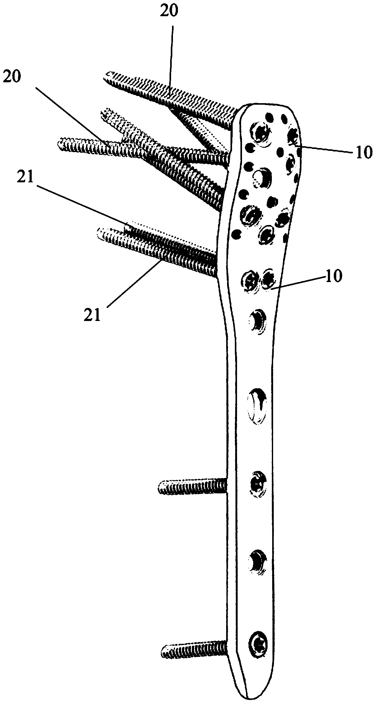 Proximal Humerus Plate