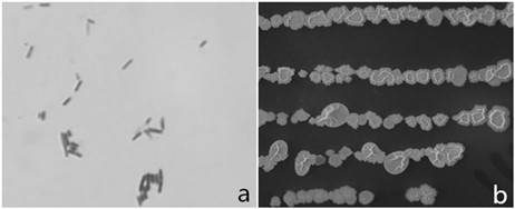 Bacillus bethecae and application of bacillus bethecae in prevention and treatment of Chinese wolfberry anthracnose