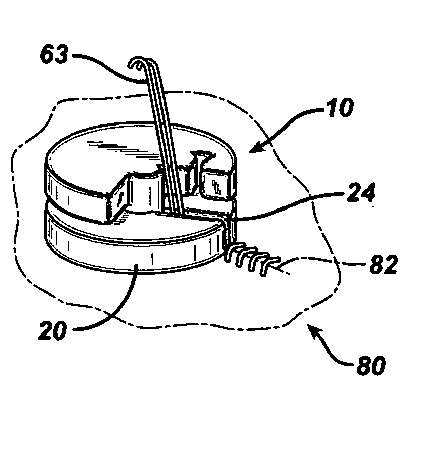 Suture anchoring device