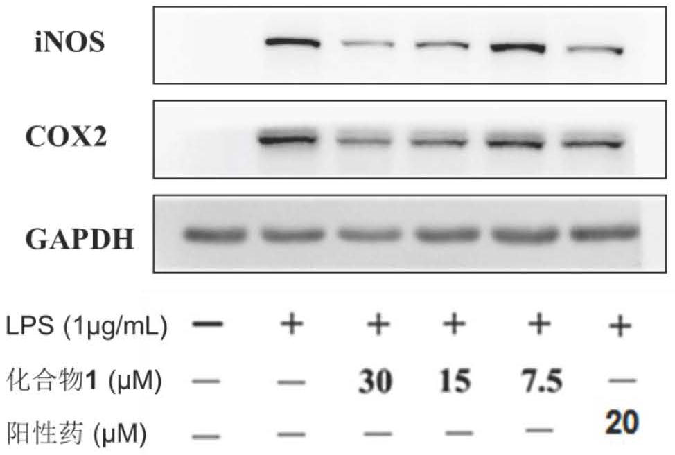 Pyxinol esterified derivatives with anti-inflammatory activity, preparation method and application thereof