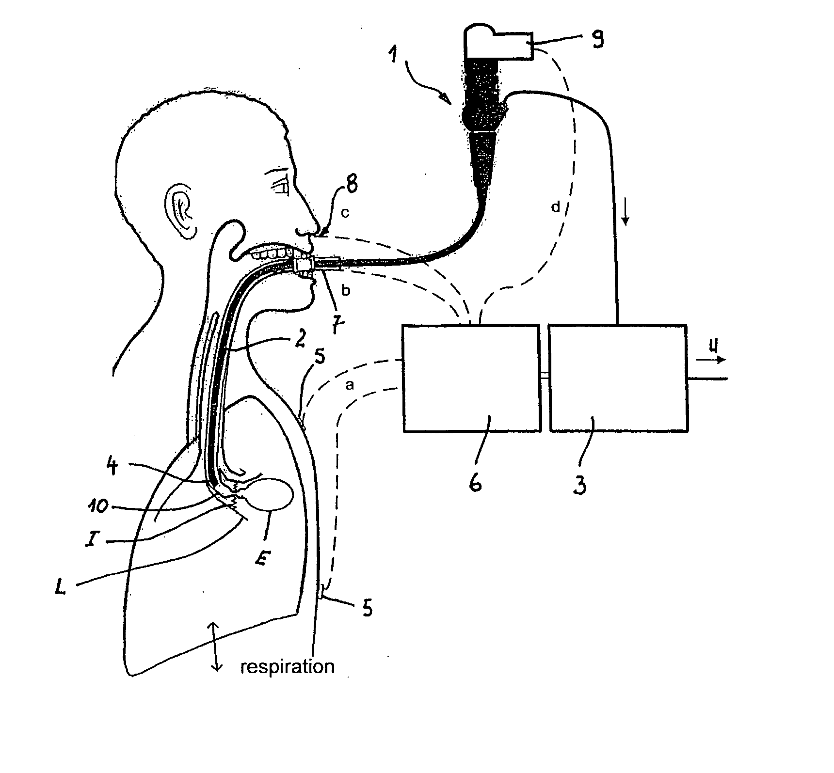 Method and arrangement for reducing the volume of a lung