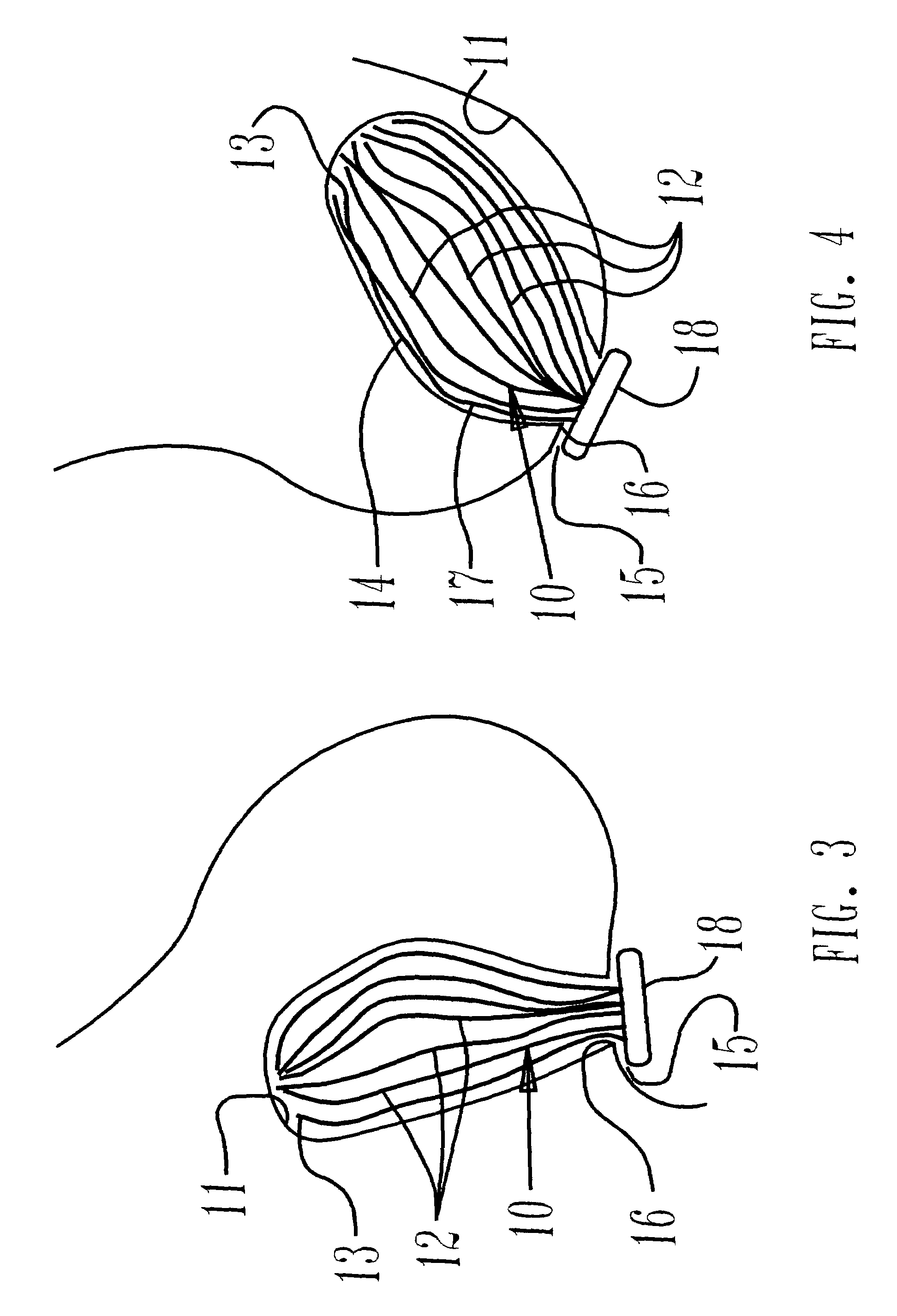 Apparatus and method for drainage