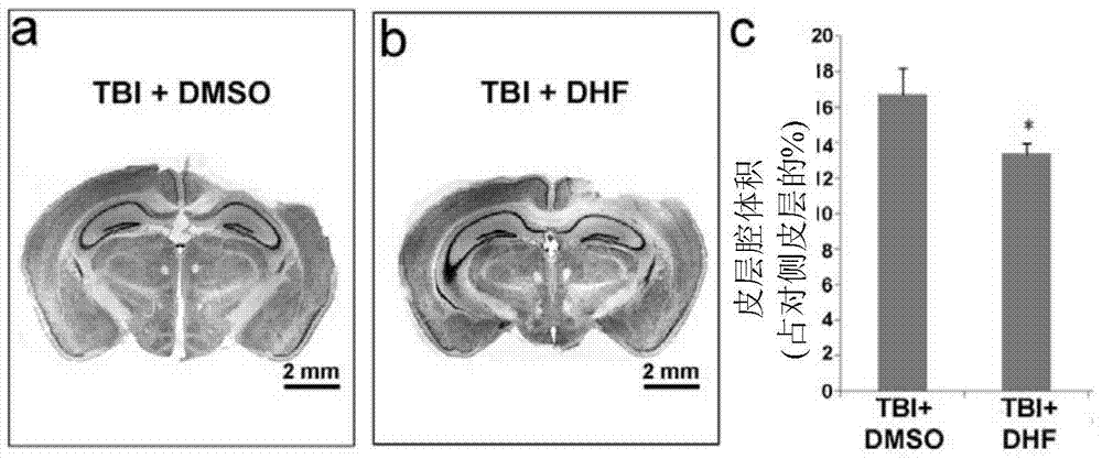 Compositions and methods for treating and preventing neuronal damage from traumatic brain injury