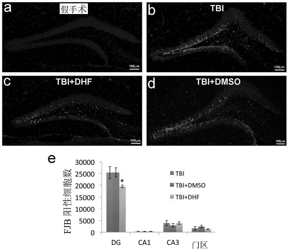 Compositions and methods for treating and preventing neuronal damage from traumatic brain injury