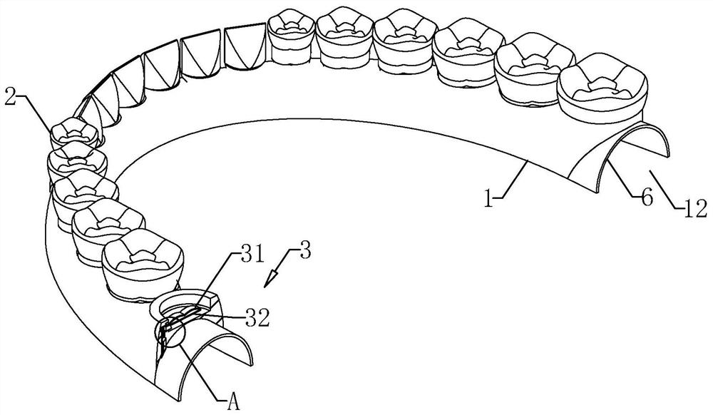 a removable denture