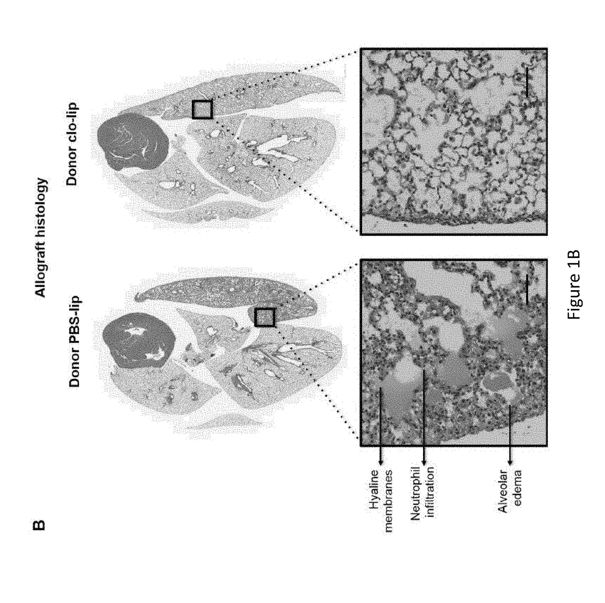 Pulmonary intravascular non-classical monocytes mediate lung transplant ischemia-reperfusion injury