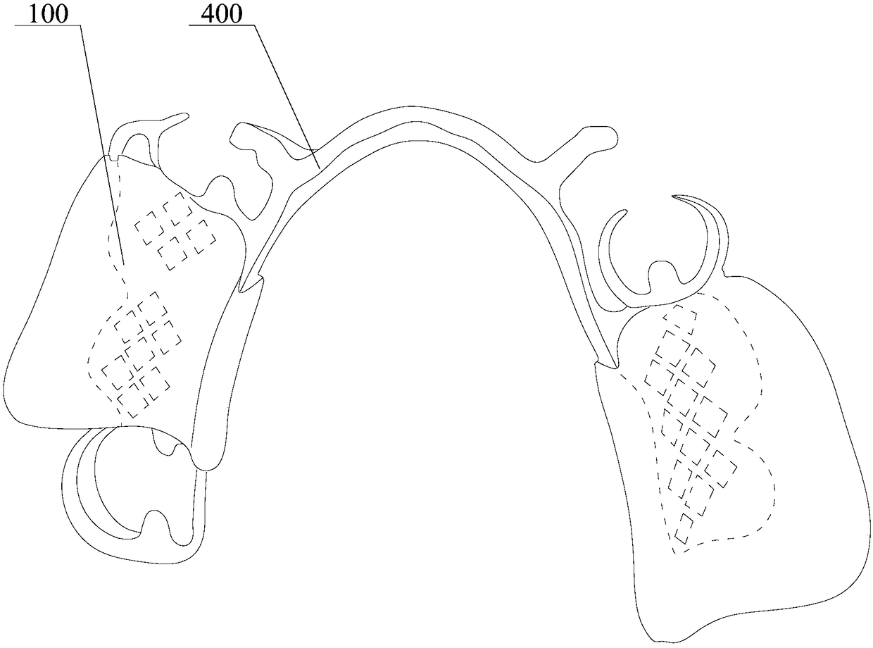 Large-area mucous membrane support-type false tooth and production method thereof