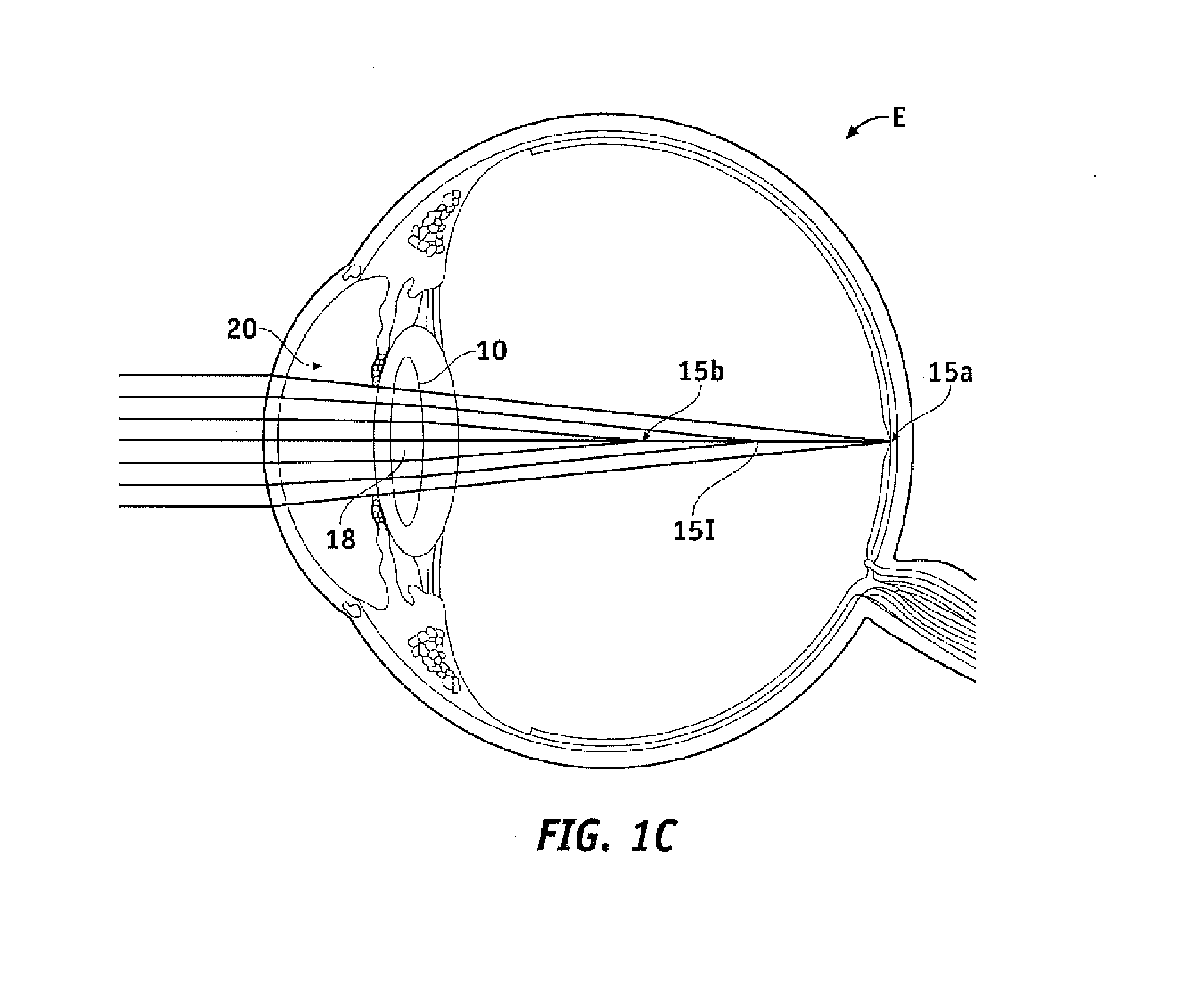 Pupil dependent diffractive lens for near, intermediate, and far vision