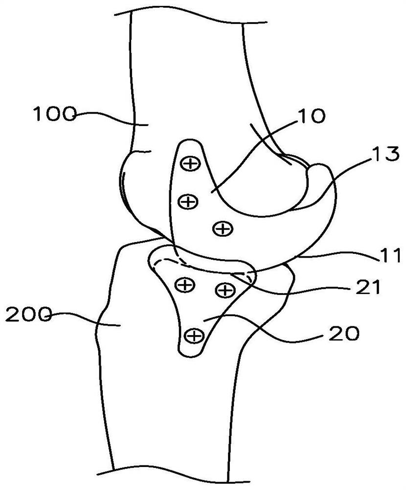 Knee joint load reducing device