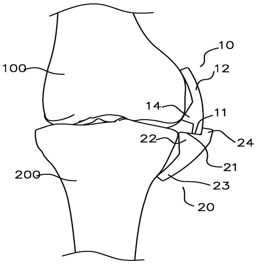 Knee joint load reducing device