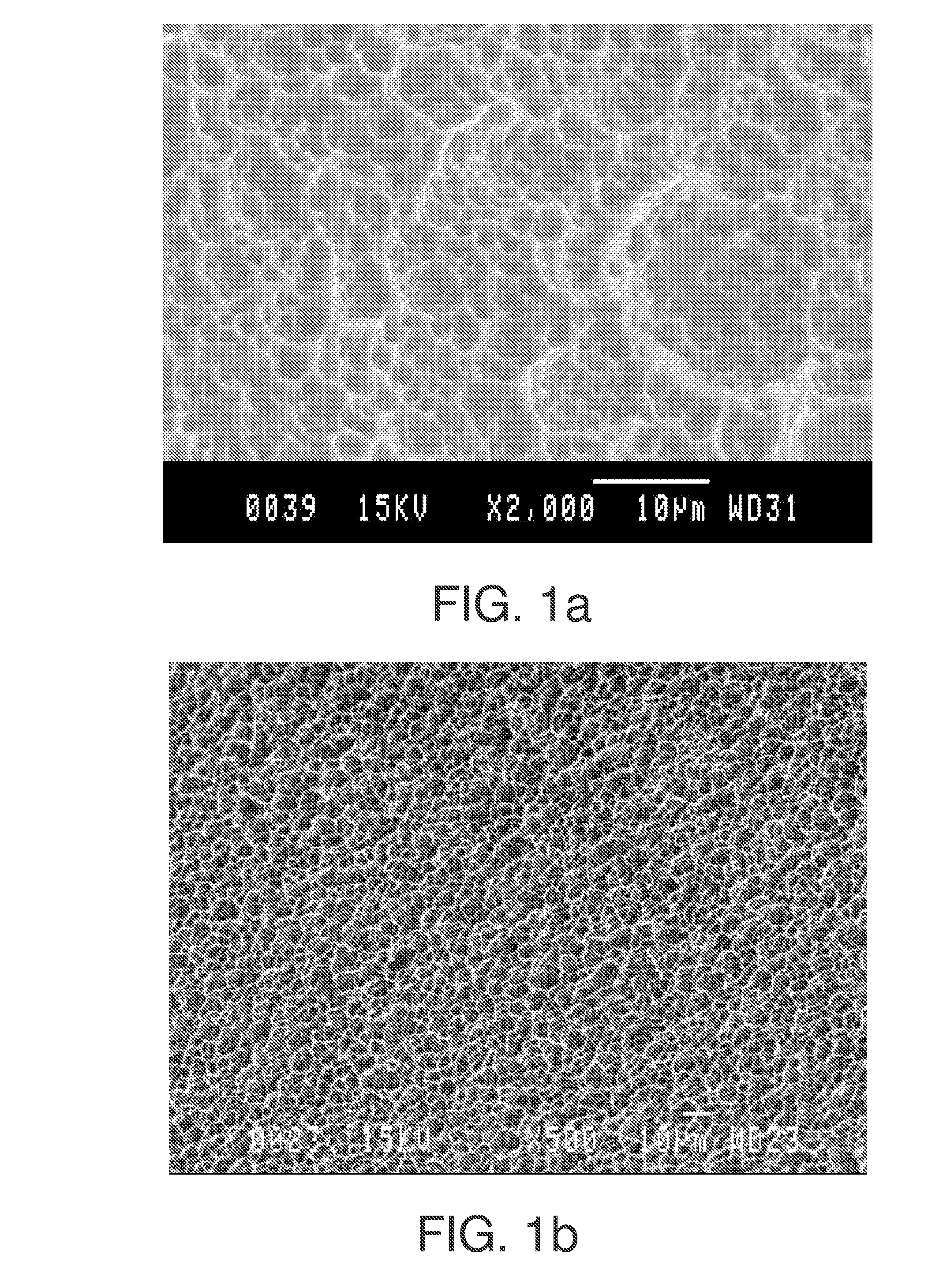 Method for obtaining a surface of titanium-based metal implant to be inserted into bone tissue