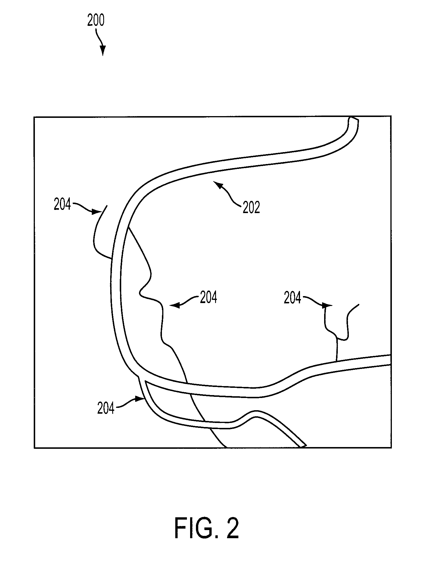 Methods and apparatus for virtual coronary mapping