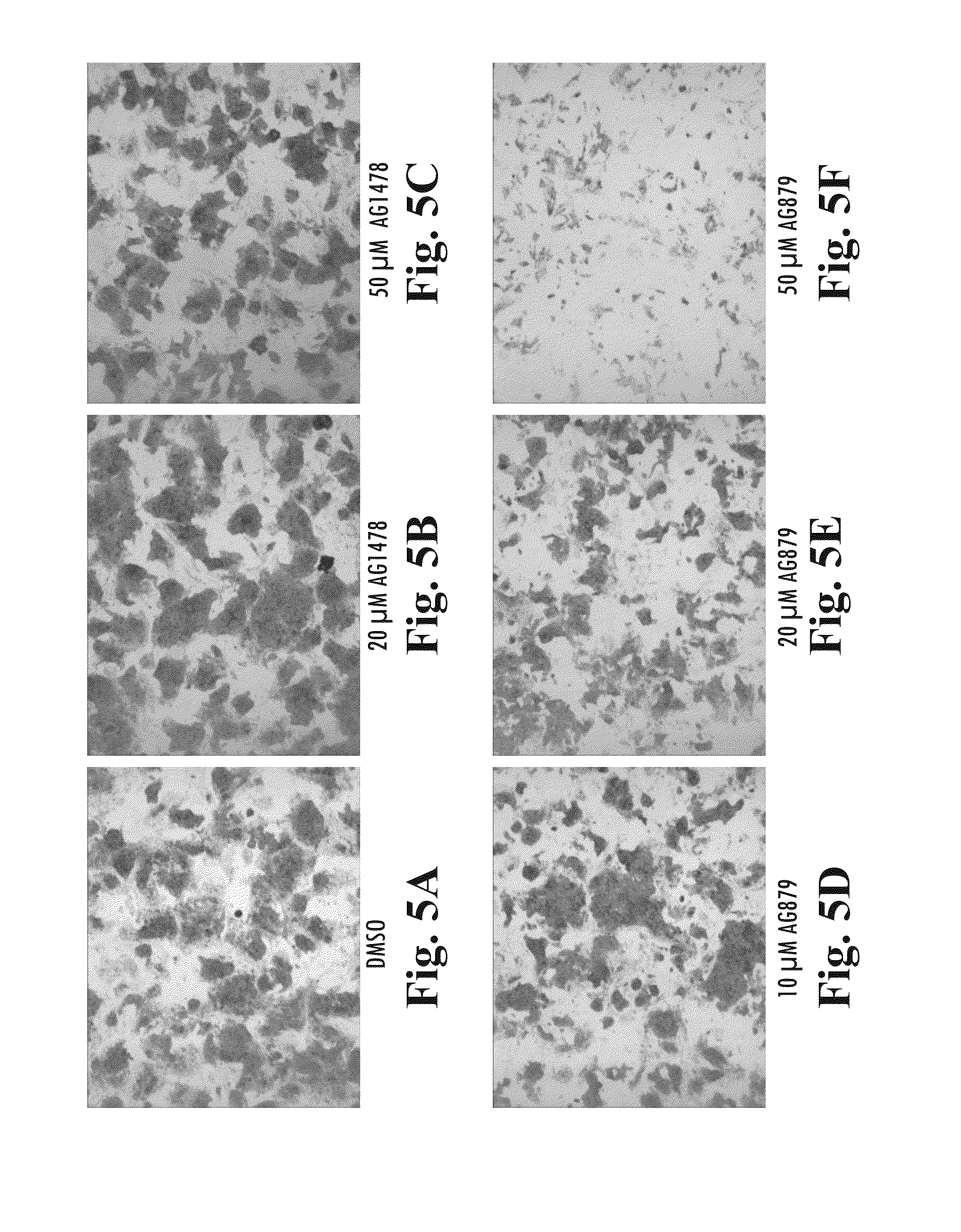 Scalable primate pluripotent stem cell aggregate suspension culture and differentiation thereof