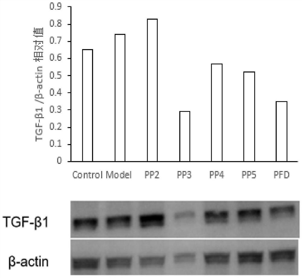 A compound targeting ubiquitination to degrade TGF-β1 and its preparation method and application