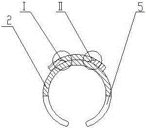 Combined surrounding bone connector